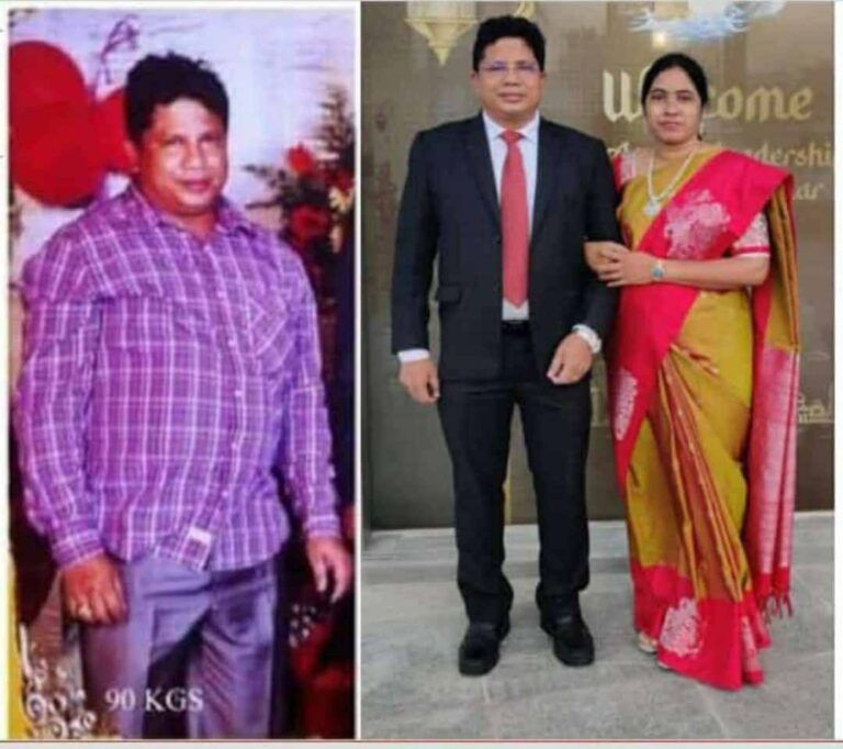 weightloss
