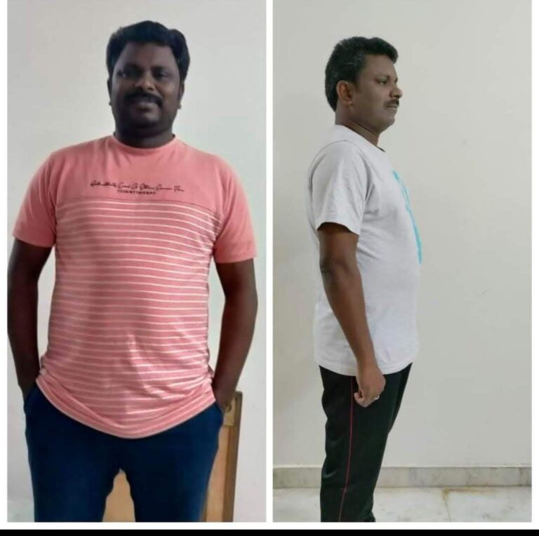 weight management